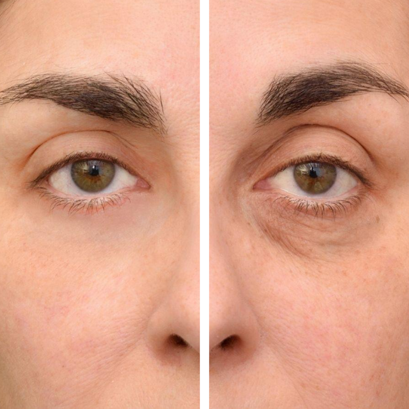 Collagen Contour Eyes Gel -Contorno de Ojos